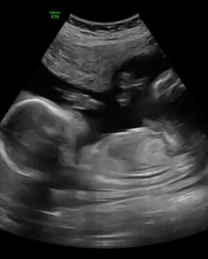 Rada Cheang Instagram - My stomach kept growing, I thought it was weight gain…..No, I’ve confirmed 7 times that it’s not a food baby that I’m carrying. We both are ecstatic….we can’t wait to meet our little miracle 🖤🖤