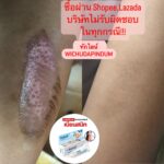 Vichuda Pindum