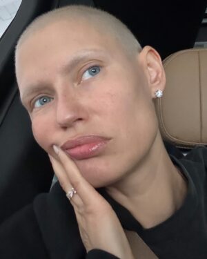 Bianca Balti Instagram - The craziest month of my life 💘 
Crazy good (not crazy bad). As good as only the first month after chemotherapy might feel. My hair are growing back and life is giving 🫶🏼