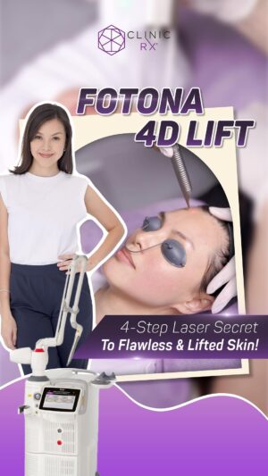 Carmen Soo Instagram - @carmen_soo chose the Fotona 4D Lift ✨ — a 4-step laser treatment that lifts, tightens, contours, and gives that radiant glass-skin glow 💫

This advanced laser treatment combines 4 powerful steps to deliver:
✔️ Deep skin tightening from within 💪
✔️ Enhanced collagen production 💉
✔️ Natural facial contouring 💁‍♀️
✔️ Resurfacing for that radiant, glowy finish ✨

Ready to experience the same glow as Carmen?
📩 DM us to book your session or visit your nearest Clinic RX outlet today! 🏥💖