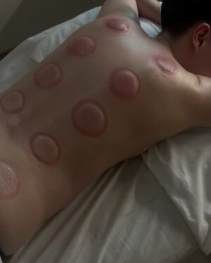 Charli Howard Instagram - Self-love can come in many forms and over the past couple of years, wellness has been so important to me, my mental health & overall wellbeing 🩷 there’s nothing wrong with taking care of yourself and as someone who is chronically anxious, it’s so important to me to destress as much as possible so I can think straighter. I went to see @olivia_lymphatics for her incredible lymphatic drainage massage & cupping which was absolute HEAVEN 🥹😭 as soon as I got home, I fell asleep for three hours. Truly one of the best and most relaxing experiences ever 🖤 #lymphaticmassage #lymphaticdrainage #wellness