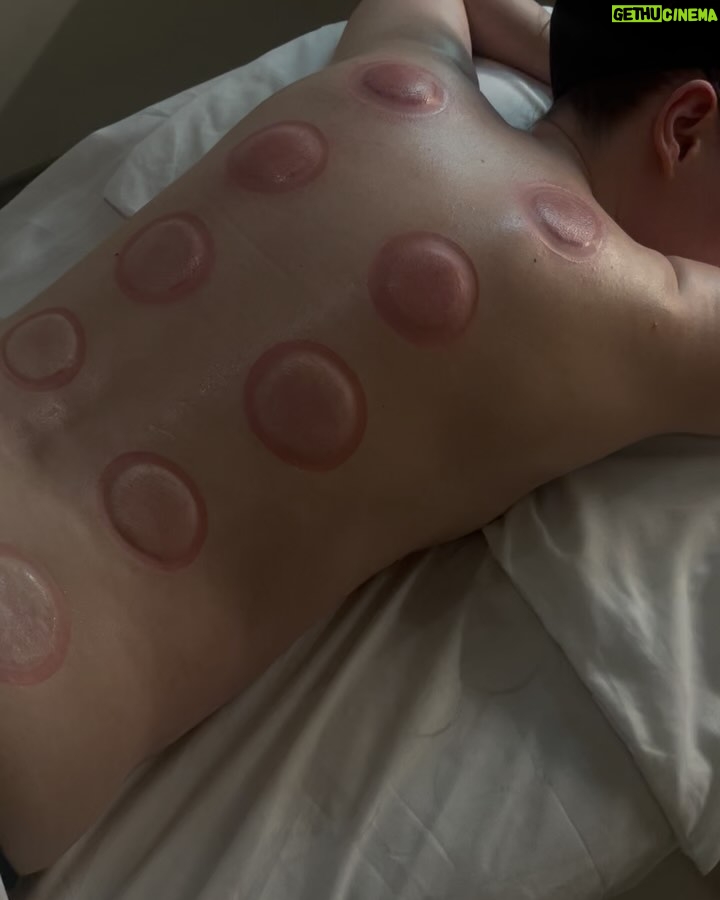Charli Howard - 6.9K Likes - Self-love can come in many forms and over the past couple of years, wellness has been so important to me, my mental health & overall wellbeing 🩷 there’s nothing wrong with taking care of yourself and as someone who is chronically anxious, it’s so important to me to destress as much as possible so I can think straighter. I went to see @olivia_lymphatics for her incredible lymphatic drainage massage & cupping which was absolute HEAVEN 🥹😭 as soon as I got home, I fell asleep for three hours. Truly one of the best and most relaxing experiences ever 🖤 #lymphaticmassage #lymphaticdrainage #wellness