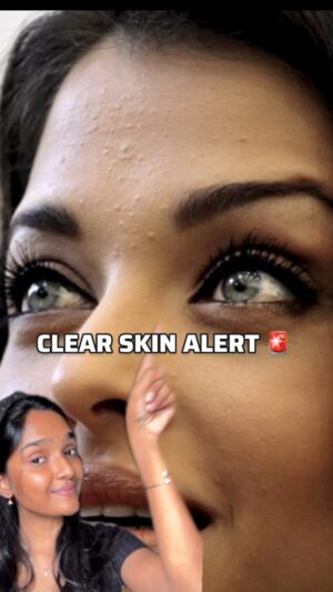 Dharshini Sambathkumar Instagram - Comment ‘link’ to get the direct link to this amazing serum 💯✨ This is an  HONEST FEEDBACK after I tried this viral serum suggested by many influencers.  This serum from @deconstruct_skincare contains 5% niacinamide and 2% alpha arbutin, designed to regulate melanin and tackle blackheads, acne marks, and hyperpigmentation. I’ve consistently used it and I’ve seriously achieved my skin goals. Who wouldn’t want a clear, glowing skin that truly works like magic, right!? 🤍✨ 
.
.
#skininfluencer #skinhealth #chennaiinfluencer #clearskin #skincare #collab