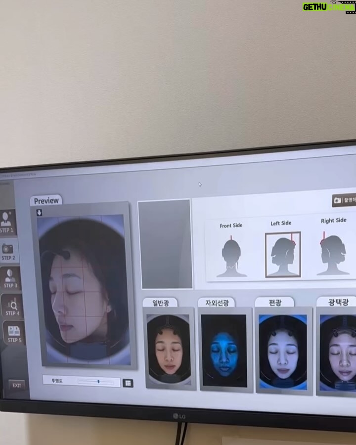 Emma Wu - 15.8K Likes - 前陣子去韓國
其實是一個重要任務
就是要讓自己還有身邊的人
變亮、變緊實、加強保濕的保養之旅
這次選擇了韓國的本思醫院
在弘大、江南還有釜山也有
(任君選擇👱🏼♀️👧🏽🧔🏽
他們會提供專業的諮詢
也不會鼓勵過度加強
(而且有中文服務喔✌🏻✌🏻✌🏻)
我的臉好一陣子沒好好維修了🧰
這次針對臉部緊緻還有輪廓
做了細緻的調整
也有做一些針對身體保養的小項目
原來身體保養也能有新的體驗✨✨✨
做完之後我自己很滿意
身邊的朋友也說臉的線條變得很好
推薦大家下次旅行時
也可以安排一場醫美之旅
好好欣賞自己、愛自己🩷🩷🩷
#這也是一種愛自己的生活
#男女都適合的醫美活動
@vands_clinic_twn