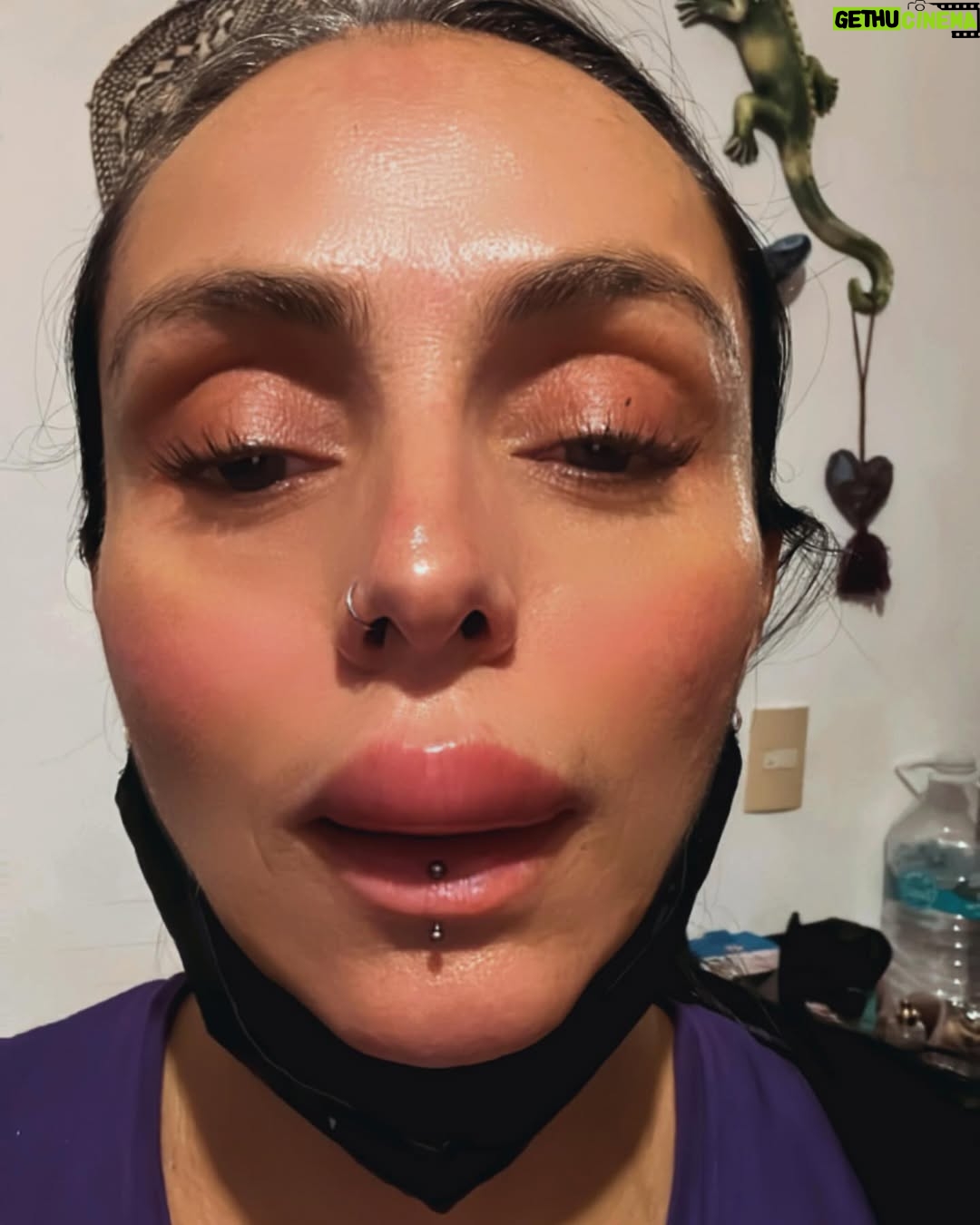 Ivonne Montero - 14.9K Likes - Pueden creerlo? 😳 Así terminó mi día anoche.. el doctor me comentó que eso no fue un piquete de ningún insecto que fue reacción alérgica algún alimento que ingerir. La verdad no soy alérgica a nada me extrañó muchísimo, además de pensar lo peligroso que puede ser.. pero ya con el medicamento que me mandó todo volvió prácticamente a la normalidad..! QUE SUSTO JAJAJA ! 😅🤪 gracias por todos sus mensajes que me enviaron.. LOS AMO TANTO!
✨🦋💞🦋✨