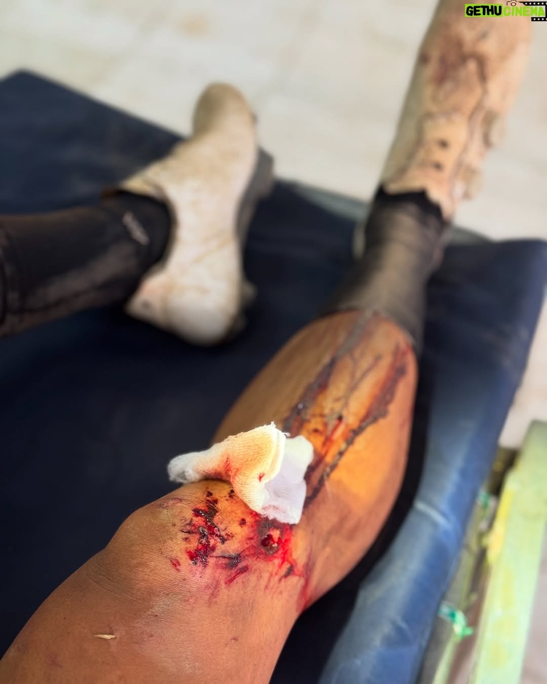 Johanna Solano - 15K Likes - Ya cansada de llorar hoy decido transformar mi dolor en palabras con el corazón roto desde mi cama de hospital, en lo que se supone que sería mi 5to día de carrera en @capeepic. 💔
El dolor físico va más allá de cualquier cosa que haya sentido, pero no se compara con el dolor que siento en el corazón por ver un sueño terminado de una forma tan abrupta. Trabajé y trabajé incansablemente por meses con un único objetivo, tuve días buenos, otros no tan buenos, me he caído y me he levantado. Jamás imaginé que la primer caída de la que no podría levantarme sería justamente mientras cumplía uno de mis sueños deportivos más grandes.
No estoy acostumbrada a que algo me detenga. No está en mi “chip” retirarme de nada. Toda mi cabeza, mi alma, mi espíritu quieren continuar con todas sus fuerzas, pero mi cuerpo no lo permite. Sé que los planes de Dios son perfectos y hoy intento con humildad aceptar que así tenía que ser, aunque me cueste todas mis lágrimas.
Ahora sólo en espera de una pequeña cirugía en mi rodilla y algunos días hospitalizada, pero llena de buena compañía y mucho amor. ❤️ ¡Gracias por todos sus buenos deseos y palabras de aliento!
P.D.: ¡Glori sigue en competencia! Mandémosle todas las buenas vibras porque afrontar las etapas que quedan, ahora solita, va a requerir de mucha cabeza. 🙏🏽 Gracias partner por todo tu apoyo, te quiero!