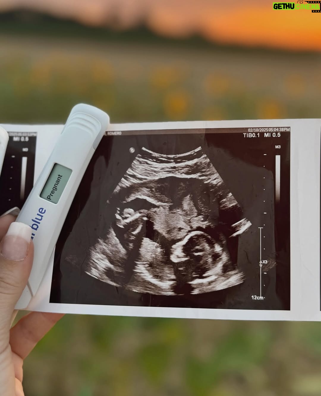 Lele Pons - 4 Million Likes - Weâre PREGNANT!!!!! đ¤°đźâ¤ď¸đĽš canât wait to meet you! We love you- Mom & Dad
BEBE EN CAMINO!! â¤ď¸â¤ď¸ contando los dĂas para conocerte, đđź te amamos. -Mama y Papa
(Photographer: @phraa )