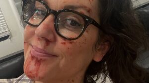 Melanie Lynskey Instagram - Episode 308 of @yellowjackets is out now! First picture was taken from the monitor by our beloved and talented makeup artist @makeupjenpowell. The second picture is me with one of my favourite members of our crew (and one of my favourite people), dolly grip Rob O’Hara. Third one is me in my trailer checking what I looked like after I’d alarmed my small child on a FaceTime. 
So grateful to the amazing women who got me through this episode- the aforementioned Jen, @floranahicepeda hair, @dafoedaily keeping us all on track, being hilarious and being the absolute greatest to chat with, @juliaabicknell for her incredible script and for being so immensely smart, kind and fun, and @directedbyanya for her insight, compassion, brilliance and great, wild ideas. How fortunate I am to get to do such crazy things at work and to get to sit opposite the great Hilary Swank for three days straight. Huge thanks to @rhysstunts and his team for their incredible work and always, always, thanks to the best crew in the world, your talent and support and kindness just makes my day every day I go to work ❤️(and for anyone yelling “spoiler!” at me because people always do no matter what I post! Yes! Shauna gets red stuff on her face! Maybe it’s strawberry jam! Maybe there’s a very simple explanation for all of this! She probably did nothing wrong!)