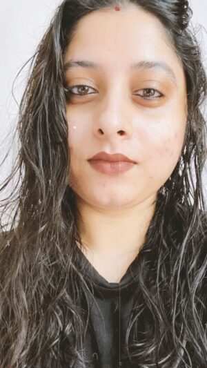 Rudrita Chatterjee Instagram - Love my scars. 
#reels #reelsinstagram #reelitfeelit #reelsvideo #reelkarofeelkaro #reel