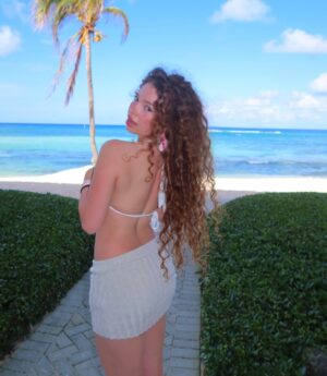 Sunday Kalogeras Instagram - I am sunburnt af☀️