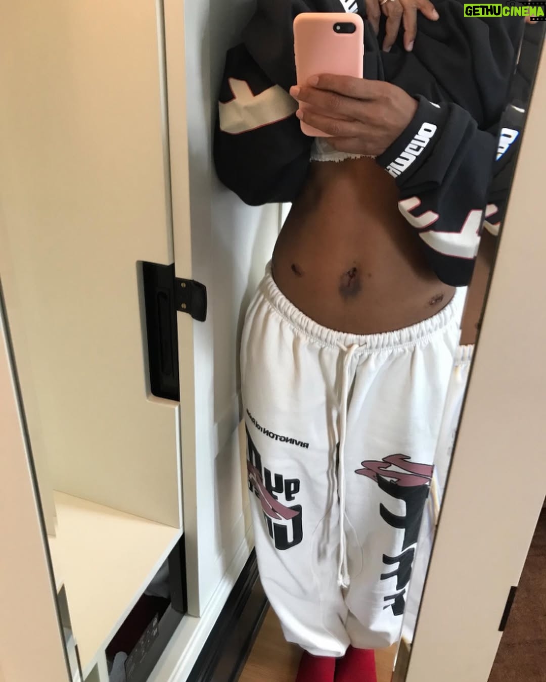 Taylour Paige - 45.5K Likes - ENDOMETRIOSIS AWARENESS MONTH! The lifelong journey of healing. Shows up in women who had to hold a lot in.Pain, heavy bleeding, adhesions- forcing oneself to take on & take in pain that doesn’t belong to you. I just saw this glorious thing on @theperiodlab she prompted “the body creates walls adhesions, just like the mind does. where are you blocking yourself from saying no and standing firm in your needs.” This has taken me a long time to learn. Goodness the self betrayal and abuse Ive internalized and would ruminate in. Those not for you benefit from this confusion. I’ve transmuted so much, but old habits die hard. A really violent illness that went undiagnosed for 20 years but caused me so much agony and turmoil. Finally had surgery fall of 2023 with Wonderful Dr Elizabeth Poynor thanks to my sister Lena. It was 4 hours long. It was on my colon, bladder and rectum. The pain would make me see stars. Throwing up every month. Sometimes couldn’t drive. the worst is how much you gaslight yourself. It’s almost like there’s no way you’re hurting this much? it definitely psychologically does something to you because it’s like you and no one around you believes the pain you’re in. The anxiety of next month. So many times I’ve ruined a costume or a good pair of jeans. In highschool my khaki uniform skirts. i learned over the last few years that endo is anger turned on yourself. You’re literally inflamed. That tracked for me. So many women are going THROUGH it okay. Be gentle with us. I am so grateful for what I’ve been able to turn around in myself over the last few years. I thank my body, I thank my husband, I thank my dear sister @ladylizzo who has taught me so much. My true health mentor. Thankful for acupuncture, clean water, protein, sauna, a calm nervous system because I’m experiencing healthy partnership and beautiful sisterhood. I’m thankful for good bloodwork and new days. Sunshine. good walks. Jumping on my mini trampoline. it’s not just one thing it’s a whole lot of things & I’m thankful we live in a time we can share & help each other! A few bloated pics, some post surgery, childhood internalizing, a good read. I love you #endometriosis