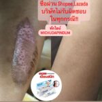 Vichuda Pindum