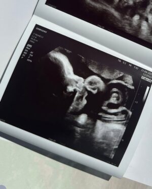 Aria Bedmar Instagram - Querido Cairo:

No tengo ni la más remota idea de cómo lo vamos a hacer, porque ni mami ni yo tenemos experiencia que nos lo cuente. Eso sí, te prometo que aprenderemos cada día, que te cuidaremos y te querremos como nadie más en este mundo. Porque, aún sin haber salido de esta tripita, ya te amamos de una forma infinita que no sabía que se podía amar. 

Esta familia llena de animales locos, hobbies frikis y mucha música te espera con los brazos abiertos y el nido calentito. Gracias por elegirnos como tus mamás.

Te amamos, mi cachorrito. 🧡
.
.
.
.
.
.
.
PD: os dejo un aperitivito de la sesión tan chuli que me hice en Cabo de Gata. Deseando enseñaros más… 🤭