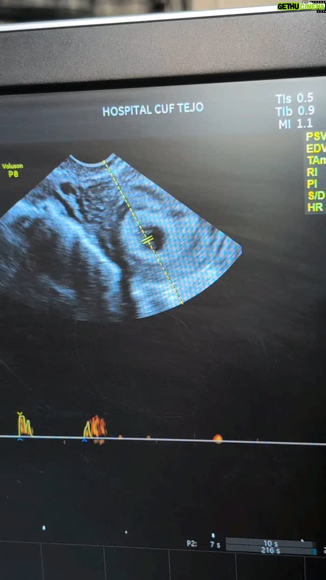 Catarina Siqueira - 5.4K Likes - O mais aceso diário de um apagão. 🤍

#firstbabypic 
#babyonboard