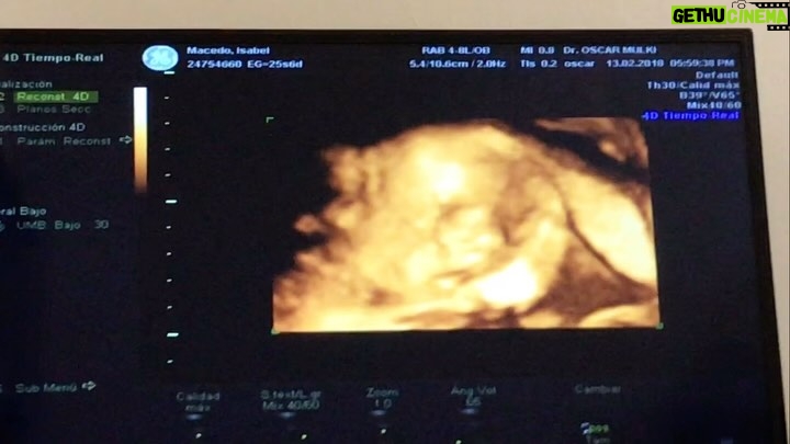 Isabel Macedo - 35.7K Likes - Hoy mi hija cumple 7.
Mi hijita tan soƱada y tan deseadaā¦
Y estoy muy emocionada. Muy agradecidaā¦
Te amo desde que te empecƩ a soƱar.