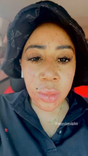 Moyo Lawal Instagram - When your skincare just don’t care 😌🥹.