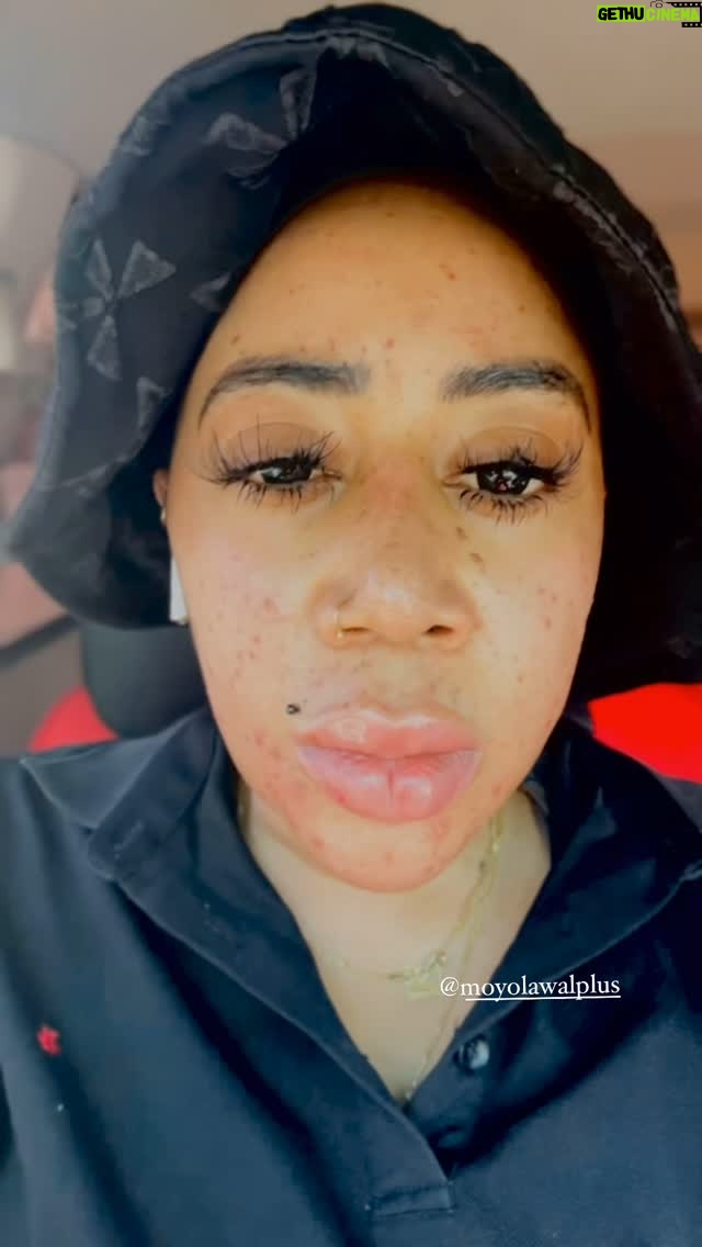 Moyo Lawal - 15K Likes - When your skincare just don’t care 😌🥹.