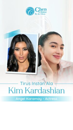 Angel Karamoy Instagram - Mau perawatan Onda Pro seperti Kim Kardashian dan @realangelkaramoy tapi masih ragu ⁉️
Percayakan dengan expertnya langsung @dr.chen_aesthetic yang sudah memilki sertifikasi International✨
Treatment Onda Pro yang dikombinasikan dengan Chen Signature yang merupakan treatment Andalan Glowers & Celebrity Glowers, akan memberikan hasil tersendiri sehingga lebih maksimal dan tahan lama✨
Tunggu apalagi Glowers? DM Sekarang‼️
📞 For More Info & Appointments:
WA: 62 812 1300 2911
WA: 62 821 2211 8478
WA: 62 852 1511 1371
📍 Wisma RMK, Jl. Puri Kencana Blok M4 No.1,
Kembangan, Kembangan Selatan,
West Jakarta 11610.
#ondapro #kimkardashian #drchen #klinikkecantikanjakarta #jakartabarat #kembangan #puri #beauty