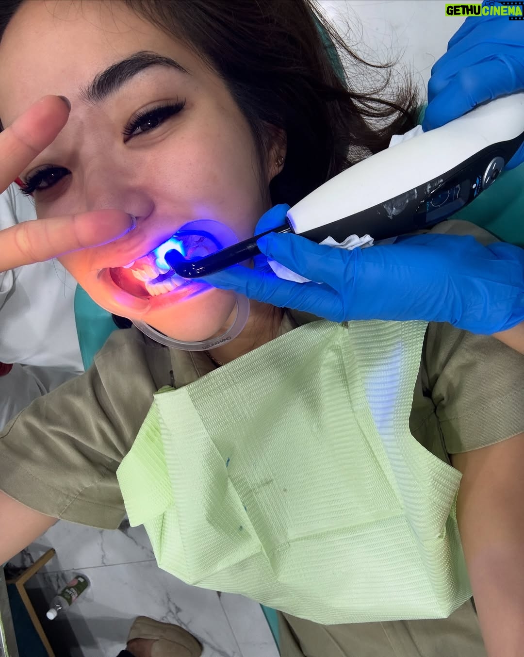 Gisella Anastasia - 50.9K Likes - Siapa disini yang ngeh kalo gigi itu bisa jadi salah satu faktor yang ikut nentuin keindahan (estetika) penampilan wajah kitaaaa? 

Perjalanan aku ngerapiin gigi sih lumayan yaaa dr jaman pindah Jkt waktu itu pasang behel, sampe udh rapiham trus kenal yg namanya veener..

Aku sih happy bgt bisa kenal dokter ian dari @smileart.id dan @flemingortho.id ..
Sm dr Ian, veneerku tu disempurnakan lg💕
Pas banget kmrn itu usia veneer pertamaku udah 8 tahun, jd udh waktunya diganti..

Dan aku SUKAAA BANGET sm hasilnyaaa..
Aku jadi lebih pede sehari2 dan makin seneng senyum😜

Makasi ya dok buat ke’perfeksionis’annya yang akhirnya bikin hasil veener nyaa cakep bgt! 🤸‍♀️
Makasi jg buat perjalan bongkar veener, cetak gigi sementara, sampe pemasangan gigi barunya yg painless, rapih, dan menyenangkan.

Untuk skrg sih ak ganti yang atas dulu ya dokk nabung2 dulu dan cari waktunya🤪 nanti next time kita gas yg gigi bawahnya lg..

Sukses selalu!!💕