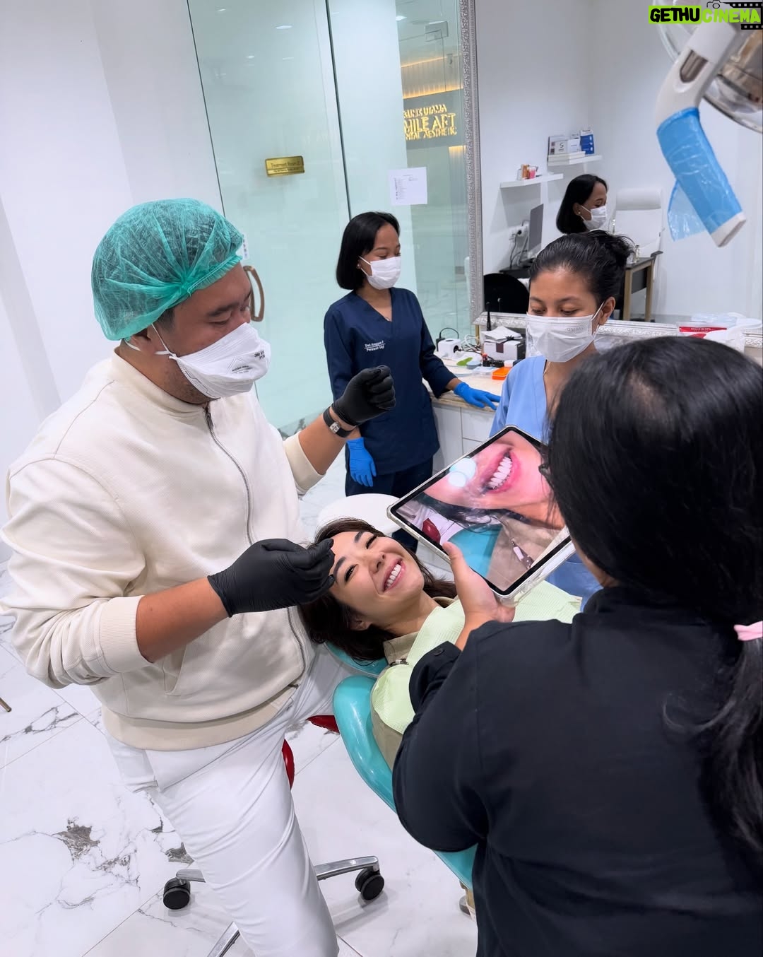 Gisella Anastasia - 50.9K Likes - Siapa disini yang ngeh kalo gigi itu bisa jadi salah satu faktor yang ikut nentuin keindahan (estetika) penampilan wajah kitaaaa? 

Perjalanan aku ngerapiin gigi sih lumayan yaaa dr jaman pindah Jkt waktu itu pasang behel, sampe udh rapiham trus kenal yg namanya veener..

Aku sih happy bgt bisa kenal dokter ian dari @smileart.id dan @flemingortho.id ..
Sm dr Ian, veneerku tu disempurnakan lg💕
Pas banget kmrn itu usia veneer pertamaku udah 8 tahun, jd udh waktunya diganti..

Dan aku SUKAAA BANGET sm hasilnyaaa..
Aku jadi lebih pede sehari2 dan makin seneng senyum😜

Makasi ya dok buat ke’perfeksionis’annya yang akhirnya bikin hasil veener nyaa cakep bgt! 🤸‍♀️
Makasi jg buat perjalan bongkar veener, cetak gigi sementara, sampe pemasangan gigi barunya yg painless, rapih, dan menyenangkan.

Untuk skrg sih ak ganti yang atas dulu ya dokk nabung2 dulu dan cari waktunya🤪 nanti next time kita gas yg gigi bawahnya lg..

Sukses selalu!!💕