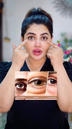Khushi Gadhvi Instagram - Under eyes 👀 problem then try this products
➡️Please check details here :-
➡️Our goal with dark circles is to reduce the appearance not to completely get rid of it as it is not possible.
➡️We need to find the cause of dark circles first and then address them dark circles are not just due to darkening of skin under the eyes but also due to structural defects of the areas around the eyes.
Here is how you can choose the what will suit
➡️Dark skin: when you stretch the skin in the under eye area, if you see a visible difference in colour between under eye skin and the colour of your cheeks, then you need to use creams with skin lightening agents. Use it consistently twice a day for 3 months to see improvement.
• If creams don't help then a few sessions of chemical peels and q switched laser also helps in lightening the darkness.
➡️Puffiness: looks for serums with caffeine in them. Caffeine is a vasoconstrictor meaning that it reduces width of vessels and fluid collection. This helps in reducing puffiness.
• If there is fat protrusion and prominent eye bags, then caffeine will not help
➡️Bluishish: Under eye area can look dark because of prominent blood vessels. Theme you stretch the skin and you see large blood vessels in the under eye, then that could be the reason for darkness. It also give a a bluish hue.
Serums with vitamin K helps in reducing appearance.
➡️Hollow: slight hollowness under the yes can also give the illusion of dark circles. This is common in young adults. Using a serum with hyaluronic acid can help in plumping the area and improving appearance.
➡️Fine lines: If you have fine lines in the under eye area then using creams with retinol and peptides helps in smoothening the area. Retinol boosts collagen synthesis while peptides effectively moisturises the under eye area.
.
Disclaimer:- the statement made about products in this video are not to diagnose, treat, cure or prevent disease. Please consult your doctor and discuss all your queries related to any disease or medicine. We intend to support, not replace, the doctor-patient relationship.
.
information on this channel should not be considered as a substitute for advice from a professional.