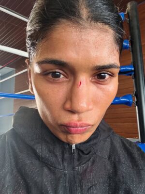 Nikhat Zareen Instagram - Bleeding nose. Bruised face. Pain didn’t stop me. Fear didn’t touch me. I didn’t come this far to stop for blood.💥🩹🦾
#BeingRelentless #FighterInAndOut