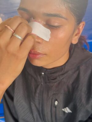 Nikhat Zareen Instagram - Bleeding nose. Bruised face. Pain didn’t stop me. Fear didn’t touch me. I didn’t come this far to stop for blood.💥🩹🦾
#BeingRelentless #FighterInAndOut