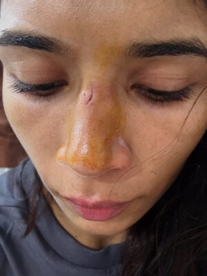 Nikhat Zareen Instagram - Bleeding nose. Bruised face. Pain didn’t stop me. Fear didn’t touch me. I didn’t come this far to stop for blood.💥🩹🦾
#BeingRelentless #FighterInAndOut