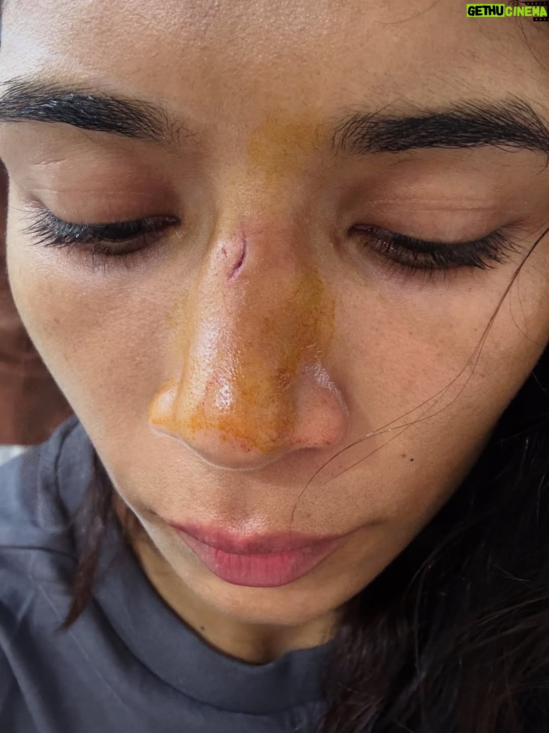 Nikhat Zareen - 16.5K Likes - Bleeding nose. Bruised face. Pain didn’t stop me. Fear didn’t touch me. I didn’t come this far to stop for blood.💥🩹🦾

#BeingRelentless #FighterInAndOut