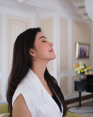 Raya Kohandi Instagram - 4 months after surgery di @indonesia_banobagi with @myvenus.io 🫶🏻🫶🏻🫶🏻
Superrr loveeee, sudah mulai natural hasilnya.. kalau ga salah di bulan ke 4 ini hasil nya sudah 85-90 % 🎉
Foto dari angle manapun, kantong mataaa sudahh hilaaang….pipi & rahang juga lebih tirus & feminim walaupun abis lebaran naik 3 kg yaaaa..
Untuk bagian kening & hidung jugaa sudah tidak terlalu kenceng lagi.. jadi ekspresi wajah sudah mulai kembali kaya dulu lagii..
Dari awal persiapan surgery - proses - dan penyembuhan sampai 4 bulan ini bener2 ga ada sakiiiitttt 🫶🏻🫶🏻