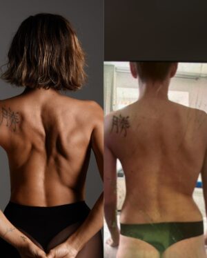 Regina Todorenko Instagram - ГОЛАЯ ПРАВДА

Перед Новым Годом у меня случилась фотосессия. Но это не одна из многочисленных съемок в красивых платьях при полном параде. Нет. На этих фотографиях я позирую с голой спиной, чтобы задокументировать свою маленькую победу. Кто-то не найдет в этой фотосессии ничего особенного, а для меня моя слабая сколиозная спина - это работа над собой, за которой стоят годы
лечения, 
непринятия своего тела,
невыносимой боли, 
угрозы от врачей о невозможности родить самостоятельно 
и полной неуверенности в себе. 
Я не ищу жалости или сочувствия. Для меня мой дефект стал стимулом и огромной мотивацией, потому что я хотела всему миру и себе доказать, что я - нормальная. За много лет я стала очень хладнокровна и устойчива к боли. И просто делаю вид, что боли нет, потому что не хочу уделять время страданиям и жалости к себе. 

2024 год для меня стал годом тела и мне удалось достаточно времени уделить своему физическому здоровью. Я все еще верю, что и без операции можно подправить особенности моей спины. И открыв глаза чуть шире, чем раньше, увидела, что несметное количество женщин испытывают неуверенность в себе. Причин множество: соски торчат в разные стороны после кормление, грудь обвисла, жир на животе, жир на бедрах, волосы слишком тонкие, волос слишком много не в тех местах и тд. Все это заставляет нас чувствовать себя некомфортно, уязвимыми. 

Этим постом я лишь хочу напомнить вам (и себе), что выход есть, что даже то, что казалось невозможным, - возможно! Я - живой тому пример. И если мои слова и действия добавят хоть толику веры кому-то из вас, я буду счастлива ♥️. 

Будьте здоровы, заботьтесь о себе!
Пусть в новом году случаются чудеса🙏🏻
(фото до и после самое последнее, стоит посмотреть) 
фото - @tigrashka