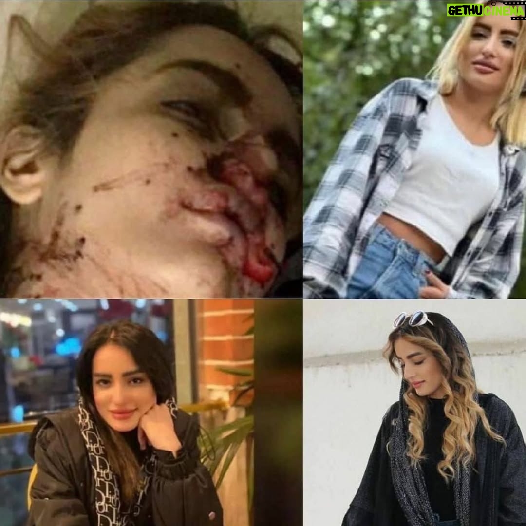 Shabnam Farshadjoo - 24.5K Likes - ما نه می بخشیم نه فراموش می کنیم ...