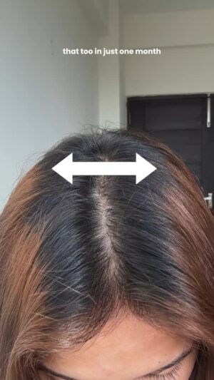 Shruti Bkshi Instagram - I was just as shocked as you when I saw how far my color has grown out from the scalp ,my hair has grown so much! 😭Honestly, it’s only been a month since I started taking my hair care seriously again. It had been a rough patch for my hair after the last incident, and it took me some time to get back on track.
But now that I’m back, I wanted to share a few of my current favorites with you!⭐️
Comment below if you want the links, and stay tuned for more videos ,I’ve been experimenting a lot with my hair care lately 👀💗
#reels #reelsi̇nstagram #viral #explore #explorepage #haircare #hair #ad #wishcare