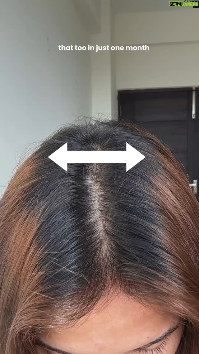 Shruti Bkshi - 9.5K Likes - I was just as shocked as you when I saw how far my color has grown out from the scalp ,my hair has grown so much! 😭Honestly, it’s only been a month since I started taking my hair care seriously again. It had been a rough patch for my hair after the last incident, and it took me some time to get back on track.
But now that I’m back, I wanted to share a few of my current favorites with you!⭐️
Comment below if you want the links, and stay tuned for more videos ,I’ve been experimenting a lot with my hair care lately 👀💗 

#reels #reelsi̇nstagram #viral #explore #explorepage #haircare #hair #ad #wishcare
