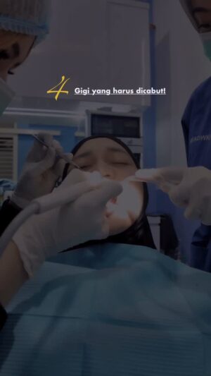 Veve Zulfikar Instagram - Sering banget banyak yang nanya, kalau pake behel perlu cabut gigi ga sih ???
jawabannya,
IYAAAA !! ( kebanyakan YAA pasti di cabut ya untuk hasil yang maximal )
cabut gigi bisa menjadi bagian dari perawatan behel, namun tidak selalu diperlukan. Keputusan untuk mencabut gigi sebelum atau selama pemasangan behel tergantung pada kondisi gigi dan rahang pasien, dan sebaiknya didiskusikan dengan dokter gigi kalian ya, dan sebelum melakukan proses pasang behel biasanya dokter memberikan rekomendasi untuk rontgen gigi panoramic / foto rontgen gigi. Jadi hati hati dalam memilih klinik & dokter ya
dan sedari dulu veve percayakan untuk perawatan gigi di @alanadivadentalcare
@alanapanigoro kliniknya ada di Surabaya, Sidoarjo, Gresik, Mojokerto, kalian bisa perawatan gigi di klinik yang terdekat dari tempat kalian yaa