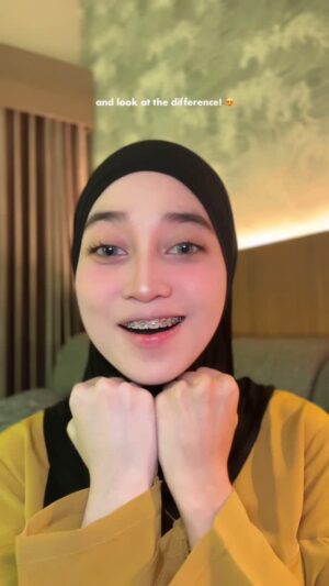 Veve Zulfikar Instagram - Rahasia Kulit Cerah Veve šš¤
yang selalu nanya kok bisa siih kulit veve cerah bgtt? ini yaa jawabannya @livior.id by @mawaddatulhaq @qonitaafatsyar_ š«¶š»
ordernya bisa melalui Instagram maupun Shopee @livior.id yaa!