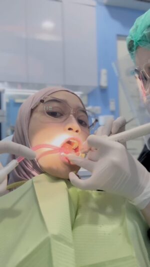 Veve Zulfikar Instagram - Kontrol Behel Gigi Time š¦·
seperti biasaa kontrol behel gigi bulanan Ve di Klinik @alanadivadentalcare with dokter @alanapanigoro š¤š«
oiya guys, Klinik @alanadivadentalcare baru aja buka cabang baru di Mojokerto looo! udah RESMI dibukaaa & lagi banyak bgtt pilihan promo yang bisa kita pilih sesuai dengan keinginan & kebutuhan kalian šš¤
sooo untuk temen-temen yang ada di Mojokerto, yang mau periksa gigi & konsultasi terkait pemasangan behel, bisa bgttt langsung gass ke @alanadivadentalcare Mojokerto šš