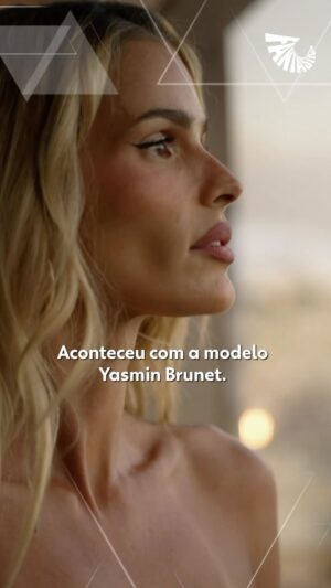 Yasmin Brunet Instagram - O #Fantástico deste domingo (9) vai falar de um problema de saúde que pode passar décadas sem diagnóstico: o lipedema. Doença crônica do tecido gorduroso que, muitas vezes, é confundida com celulite. Aconteceu com a modelo @yasminbrunet. Saiba quais são os sintomas e que tratamentos são realmente eficazes contra esse acúmulo de gordura que causa dores e mexe com a autoestima.