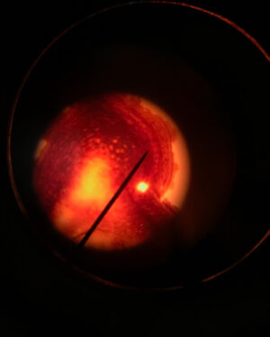 Emma Schweiger Instagram - Issa cheek cell