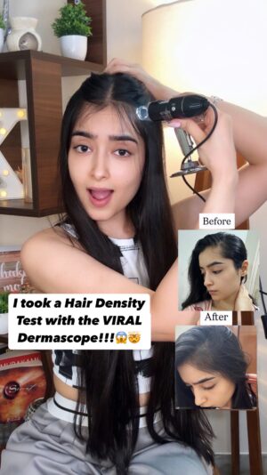 Kareena Tekwani Instagram - I took Hair Density Test with the VIRAL Korean Dermascope Device 🤯😱
I’m sure you’ve been seeing those expensive Korean Scalp Tests A LOT on your feed, but I decided to do it AT HOME, with this Microscope Device that captures & analyses your hair density accurately!
And to know if this really works, i tried it with @discoverpilgrim Advanced Hair Growth Serum, that i consistently used on my hair for 28 days & could see a Massive Difference through the device😱
This serum isn’t greasy at all, so you can use it daily without the fear of an oily scalp plus this also has amazing hair ingredients like Redensyl, Anagain, Biacapil & Korean Black rice that help with quick hairgrowth✅
Drop “hair growth” for links of both 🔗
Show your love if this was useful ❤️
(Scalp Test at Home, Korean Scalp Test, Scalp Treatment, Hair Growth, Long Hair)
#koreanscalptest #dermascope #scalptest #hairdensity #hairgrowth #koreanhair #voluminoushair #baldpatches #hairhealth