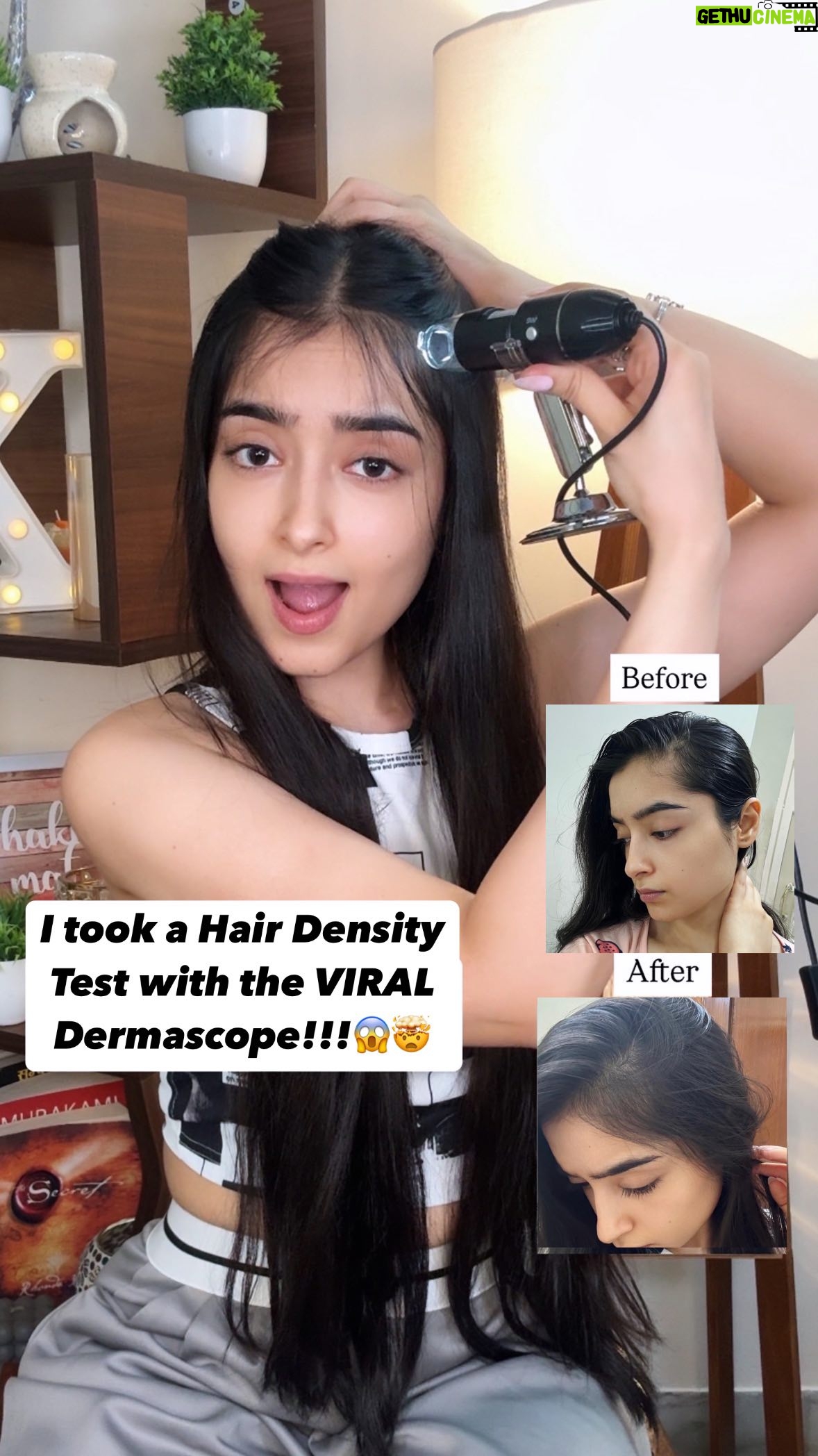 Kareena Tekwani - 6.9K Likes - I took Hair Density Test with the VIRAL Korean Dermascope Device 🤯😱

I’m sure you’ve been seeing those expensive Korean Scalp Tests A LOT on your feed, but I decided to do it AT HOME, with this Microscope Device that captures & analyses your hair density accurately!

And to know if this really works, i tried it with @discoverpilgrim Advanced Hair Growth Serum, that i consistently used on my hair for 28 days & could see a Massive Difference through the device😱

This serum isn’t greasy at all, so you can use it daily without the fear of an oily scalp plus this also has amazing hair ingredients like Redensyl, Anagain, Biacapil & Korean Black rice that help with quick hairgrowth✅

Drop “hair growth” for links of both 🔗
Show your love if this was useful ❤️

(Scalp Test at Home, Korean Scalp Test, Scalp Treatment, Hair Growth, Long Hair)

#koreanscalptest #dermascope #scalptest #hairdensity #hairgrowth #koreanhair #voluminoushair #baldpatches #hairhealth