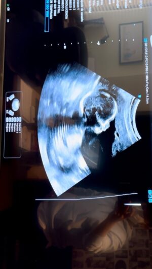Katherine Escobar Farfan Instagram - Nuestra niña, nuestra muñeca, “nuestra Joy Devia Escobar”.
¡Gracias Dios, gracias Dios, gracias Dios!