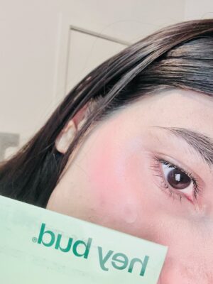 Kirti Bhatia Instagram - Say goodbye to surprise breakouts with @heybudskincare #10millionbuds 🌿 Their pimple patches are my new skin saviour 💚
#heybudskincare #foryou #explore #trend #insta #skincare #melbourne