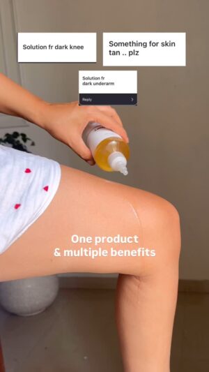 Kiwi Tandon Instagram - Glycolic acid is one of those ingredients that works wonders and have been loved by so many dermatologists.
It’s amazing for treating dark knees, dark underarms, neck and elbow pigmentation, even back acne marks , ingrown hair & dandruff too 

It gently exfoliates and helps brighten over time. You can use it on your face too, but if you have sensitive skin, start with a lower percentage, as 7% can be a bit strong.
 
🔅When to apply ? Always at night time ( twice a week ) and next day sunscreen is really important 🤌🏻

 🔆 if using on scalp , leave it for 10 mins and rinse with shampoo

🔅 On body leave it overnight 

You can use any & in the video I was using is by @theordinary 

#glycolicacidtoner #glycolicacid #ordinaryglycolicacid #darkspots #darkelbows #darkunderarm #underarmpigmentation #suntan #skincarehacks #tranexamicacid #ingrownhair #keratosispilaris #bumpyskin #strawberryskin #strawberrylegs #flakyscalp #dandrufftreatment #acnemarks