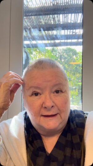Magda Szubanski Instagram - Lovelies. Well. Some not great news. I’ve been diagnosed with stage 4 Mantle Cell Lymphoma—a rare and fast-moving blood cancer. It’s serious, but I’ve started one of the best treatments available (the Nordic protocol), and I’m lucky to be getting absolutely world-class care here in Melbourne.
I won’t sugar-coat it: it’s rough. But I’m hopeful. I’m being lovingly cared for by friends and family, my medical team is brilliant, and I’ve never felt more held by the people around me.

I’ll be lying very low while my immune system takes a hammering, so if you see me out and about—don’t hug me, kiss me, or breathe anywhere near me! Wave enthusiastically from a safe distance and know I love you madly.

This is an obscure cancer and was only discovered incidentally via a breast screen where they found my lymph nodes were up. 
TBH, I’ve been feeling pretty ratshit for ages. So I asked for extra  bloods and - voila!
So the take away is - get tested and listen to your body!

For now, just know I’m in good hands, good spirits—but I reserve my yuman right to be a cranky old moll. 
Love you all, Mags 🩷🙏🩷👩‍🦲