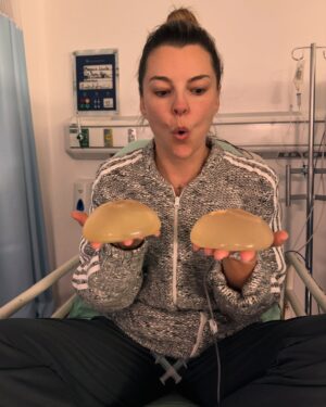 Marjorie de Sousa Instagram - Hoy 5 de Mayo 🙌🏻 cumplo un año que decidí quitarme los implantes 🙌🏻🙌🏻🙌🏻aquí justo me acababan de sacar del quirófano, mis ojos súper hinchados cosa ya común últimamente 🥺te puedo decir que me siento mejor que nunca, que amo el trabajo que hizo en mi el doctor @alangonzalezmd y que doy gracias por sus manos y talento 🥰🙌🏻 me siento saludable, mi vida cambió muchooooo, mi piel, mi ánimo, mi salud hoy está mejor que nunca, los síntomas que tenía desaparecieron casi en su totalidad 🥰incluido la intensidad de mis dolores de cabeza, gracias, gracias, gracias 🥰🙏🙌🏻🙌🏻🙌🏻 si tienes síntomas y sobre todo miedo 🙏no lo dudes y no tengas miedo que estarás mucho mejor 🥰  te gustaría quitarte los implantes ??? P.D. Cada quien hace con su vida y su cuerpo lo que quieren, comparto esto ya que como yo muchas mujeres están pasando y pasaron por muchos síntomas sin tener respuestas en exámenes médicos 🙌🏻a quien le quede que lo lea y a las que aman sus implantes felicidades 🥰 no es moda es salud ♥️