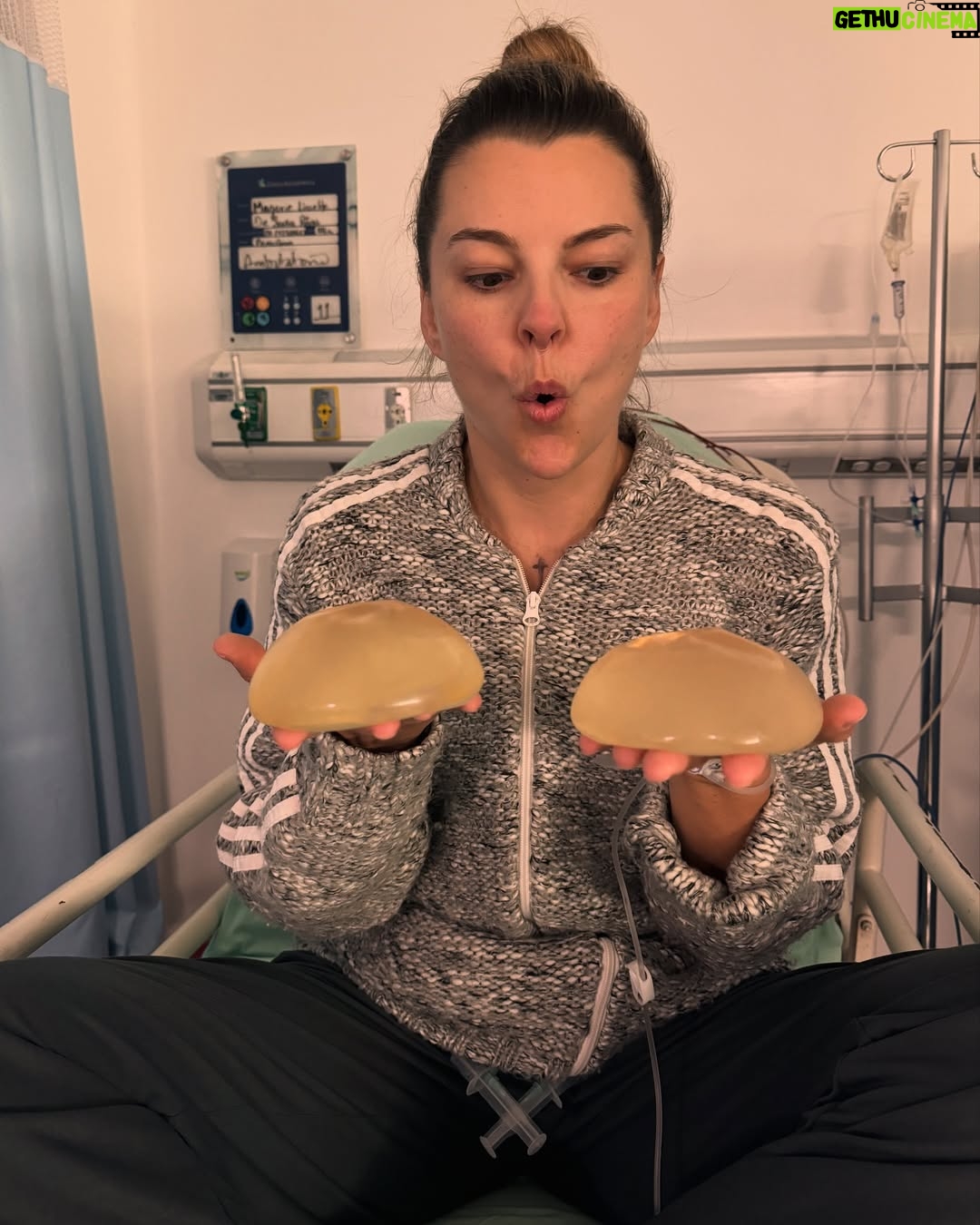 Marjorie de Sousa - 163.1K Likes - Hoy 5 de Mayo 🙌🏻 cumplo un año que decidí quitarme los implantes 🙌🏻🙌🏻🙌🏻aquí justo me acababan de sacar del quirófano, mis ojos súper hinchados cosa ya común últimamente 🥺te puedo decir que me siento mejor que nunca, que amo el trabajo que hizo en mi el doctor @alangonzalezmd y que doy gracias por sus manos y talento 🥰🙌🏻 me siento saludable, mi vida cambió muchooooo, mi piel, mi ánimo, mi salud hoy está mejor que nunca, los síntomas que tenía desaparecieron casi en su totalidad 🥰incluido la intensidad de mis dolores de cabeza, gracias, gracias, gracias 🥰🙏🙌🏻🙌🏻🙌🏻 si tienes síntomas y sobre todo miedo 🙏no lo dudes y no tengas miedo que estarás mucho mejor 🥰  te gustaría quitarte los implantes ??? P.D. Cada quien hace con su vida y su cuerpo lo que quieren, comparto esto ya que como yo muchas mujeres están pasando y pasaron por muchos síntomas sin tener respuestas en exámenes médicos 🙌🏻a quien le quede que lo lea y a las que aman sus implantes felicidades 🥰 no es moda es salud ♥️