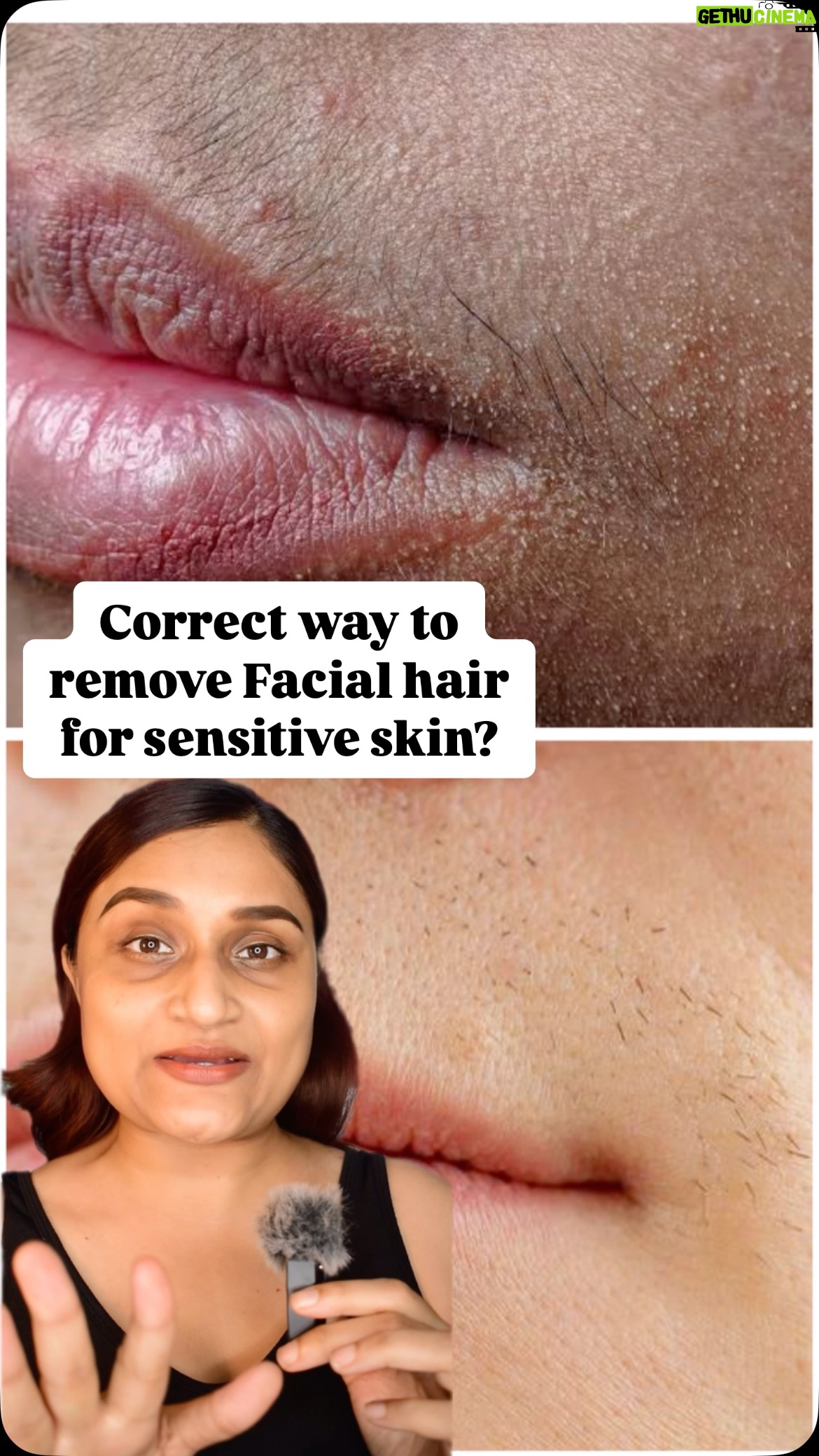Mukul Richards - 1.5K Likes - What method of facial hair removal works for you?? #agaro #facialhairremoval #facialhairdontcare #facialhair