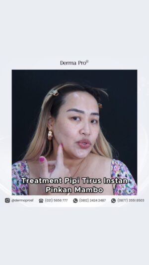 Pinkan Mambo Instagram - Ini dia Laser Aton rahasia pipi tirus instant nya kak Pinkan @pinkan_mambo
Proses tanpa oprasi minim sakit dan hasilnya bisa langsung terlihat pasca treatment, hasil dan akan semakin max setelah 1 minggu pengerjaan..
Yu konsultasikan segala kebutuhan estetik kamu sekarang juga di klinik @dermaprosf Konsultasinya Gratis loh darling š¤
Booking Treatment & Konsultasi :
āļø 021 5656 777
š± 0812 2424 2487
š± 0877 3551 8503
š± 0813 2042 0410
š Jl. Tanjung Duren Barat VI, No.16, Jakarta Barat
ā° Senin - Sabtu : 09:00 - 18:00
ā° Minggu : 09:00 - 16:00
#dermaprosf #laseraton #pinkanmambo #facialwajah #klinikkecantikan #kulitglowing #jakartabarat #aestheticclinic #klinikaesthetic #salmondna #slimmingtreatment #infuswhitening #infusvitamin #klinikslimming #wajahglowing #wajahtirus #vshape #laseraton #laserwajah #laserjerawat #klinikjerawat #hifu #facetightening #photorejuvenation #photorejuve #klinikvaginajakarta #feminity #hairremoval #hairgrowth #klinikrambut