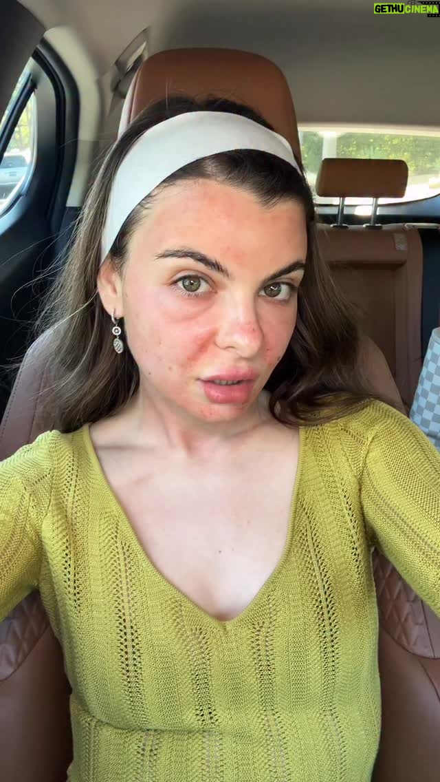 Yanina Mak - 82 Likes - Microneedling  PRP 🫶🏻

#microneedling#prp#glowingskin#women#slavicgirl#cosmetology#losangeles